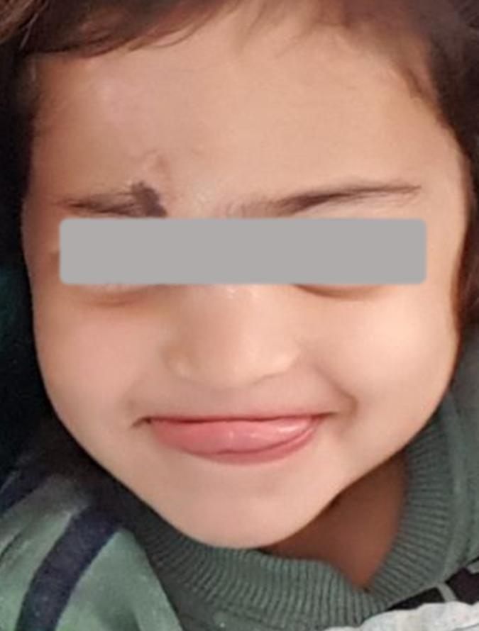 After treatment: healed