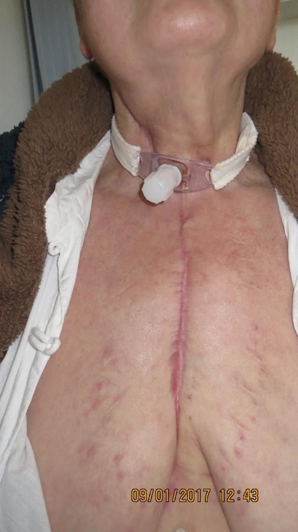 After treatment: healed