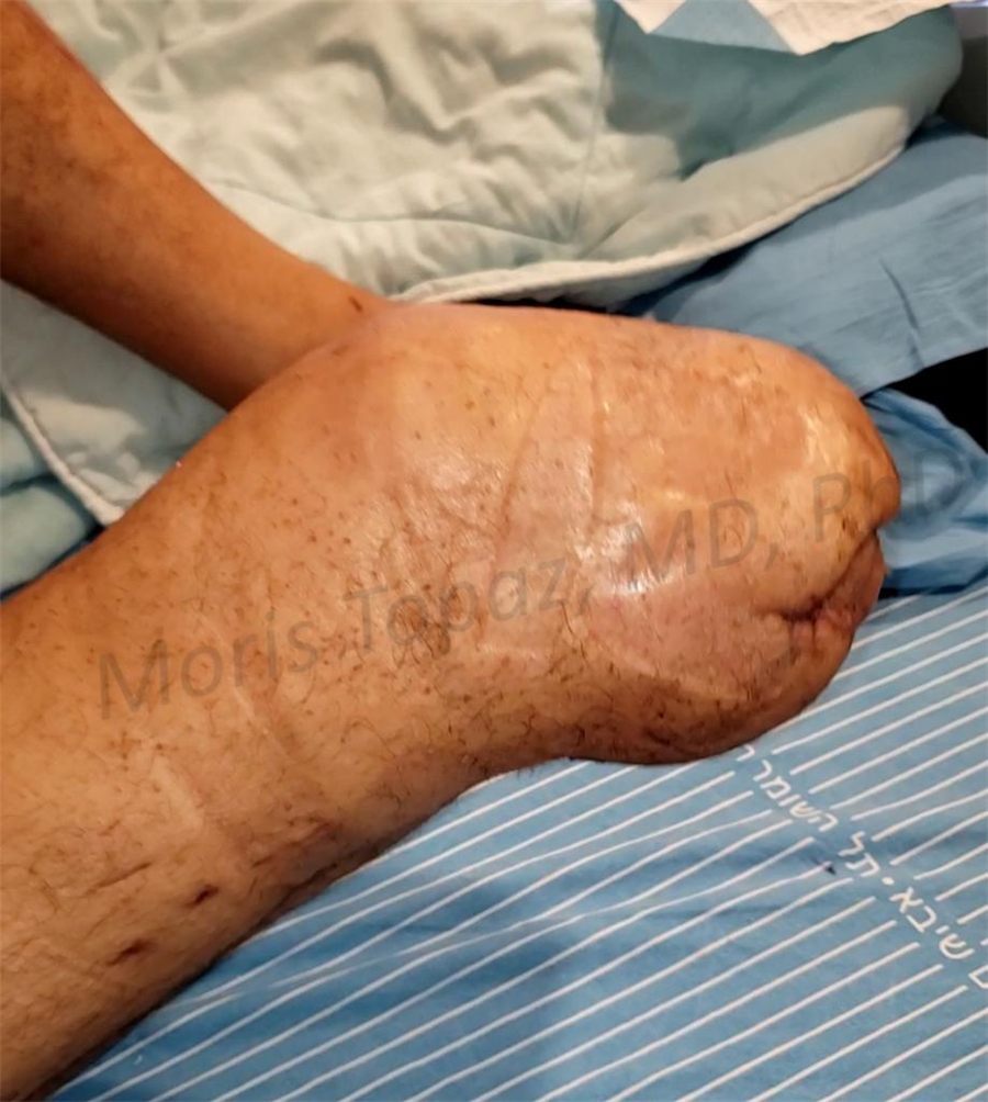After treatment: healed