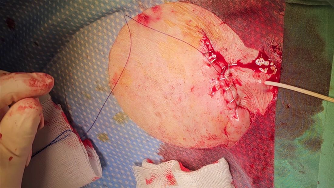 CITA targeted antibiotic delivery