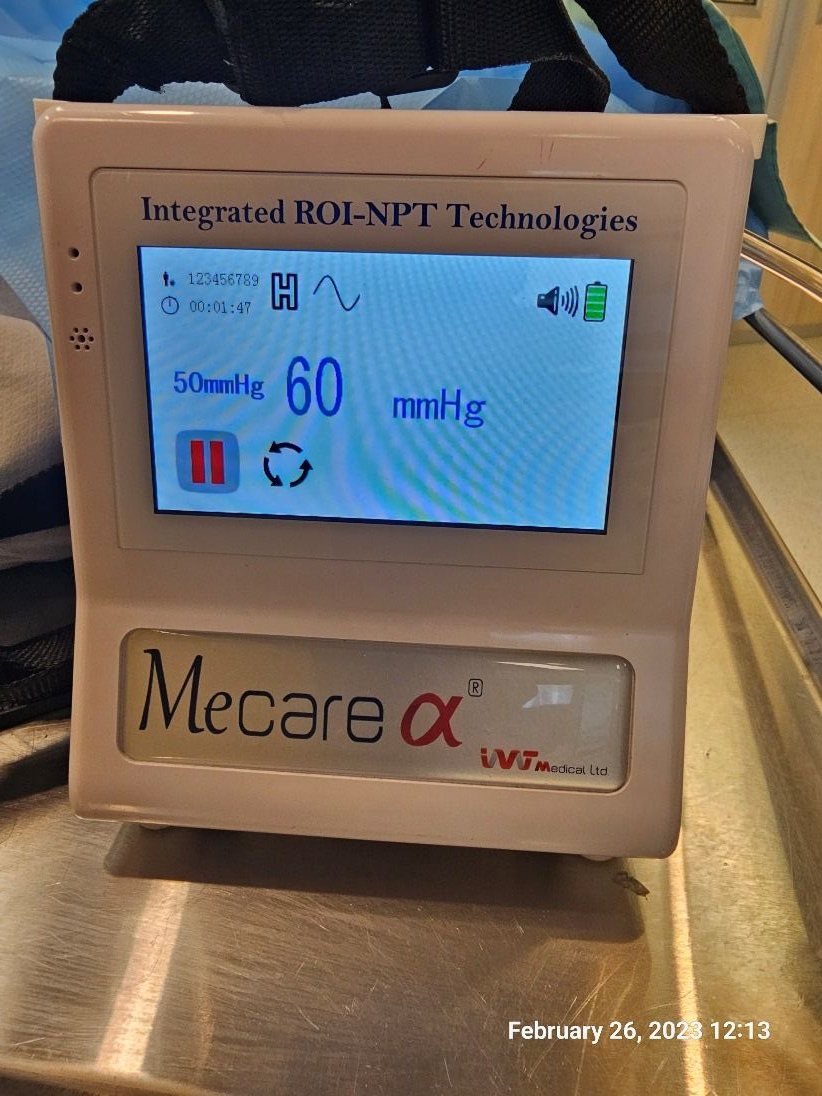 MeCare regulated ROI-NPT device during therapy