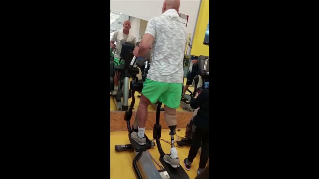 Patient ambulating with prosthesis